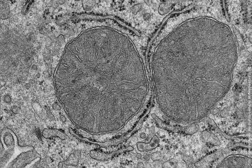 Elektornenmikroskopaufnahmen von Mitochondrien