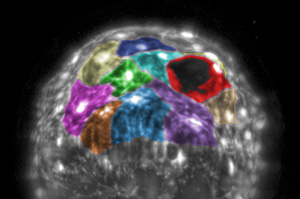 serosal tissue morphology