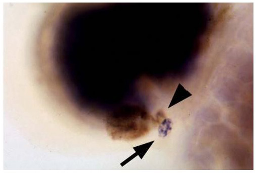 Fig-2