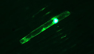 gfp-blh3