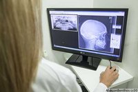 Ansicht auf Bildschirm mit geröntgtem Schädel