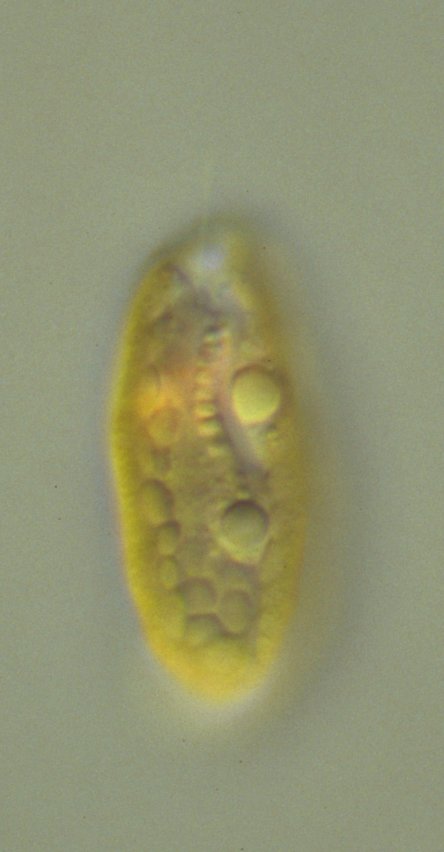 Differential interference contrast photomicrograph of 
a Cryptomonas cell focused onto the open furrow