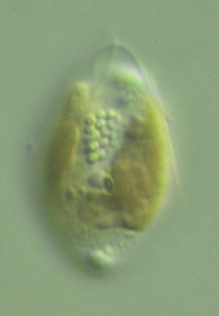 Differential interference contrast photomicrograph of a 
freshwater Rhodomonas